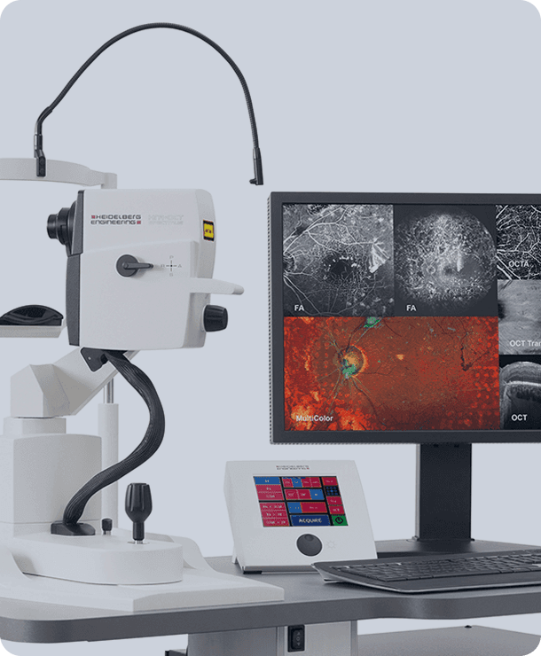 Comment diagnostiquons-nous le glaucome ?