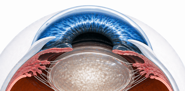 cataract eye image