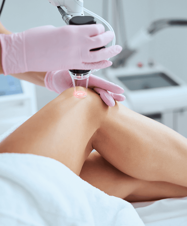 Laser and Skin Treatments