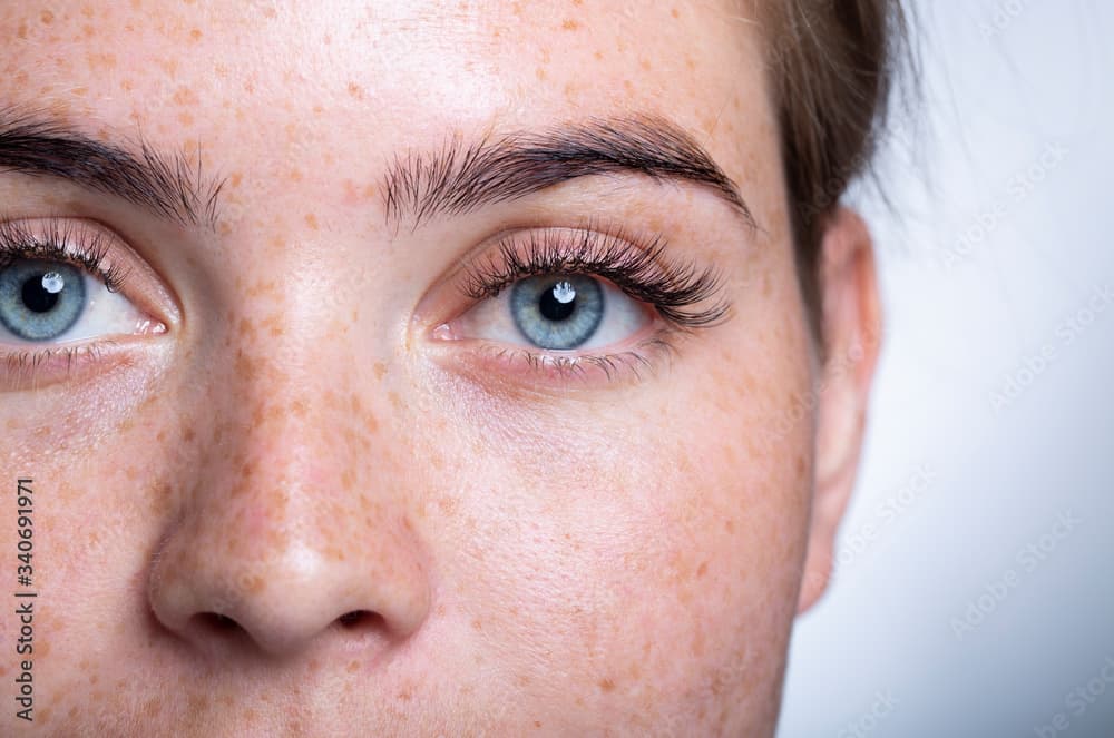 Tout savoir sur l’opération laser des yeux : sécurité, efficacité et technologies avancées